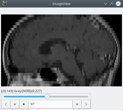 mri_sagittal.jpg